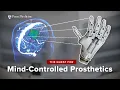 Thought-Controlled Prosthetics A Brain-Computer Interface Breakthrough