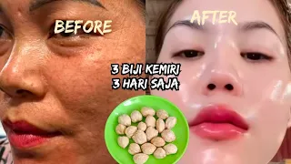 Cukup 3 Butir Kemiri!! Tuntaskan Flek & Kriput, Wajah Tua Jadi Muda!! 
