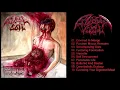 Download Lagu 𝐁𝐥𝐨𝐨𝐝𝐛𝐨𝐢𝐥 - 𝐅𝐞𝐬𝐭𝐞𝐫𝐢𝐧𝐠 𝐅𝐨𝐫𝐧𝐢𝐜𝐚𝐭𝐢𝐨𝐧 𝟐𝟎𝟎𝟔