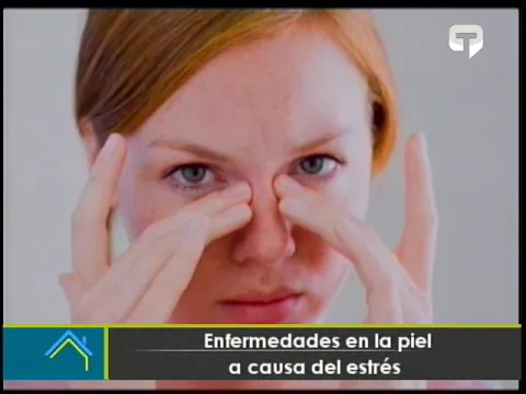 Enfermedades en la piel a causa del estrés