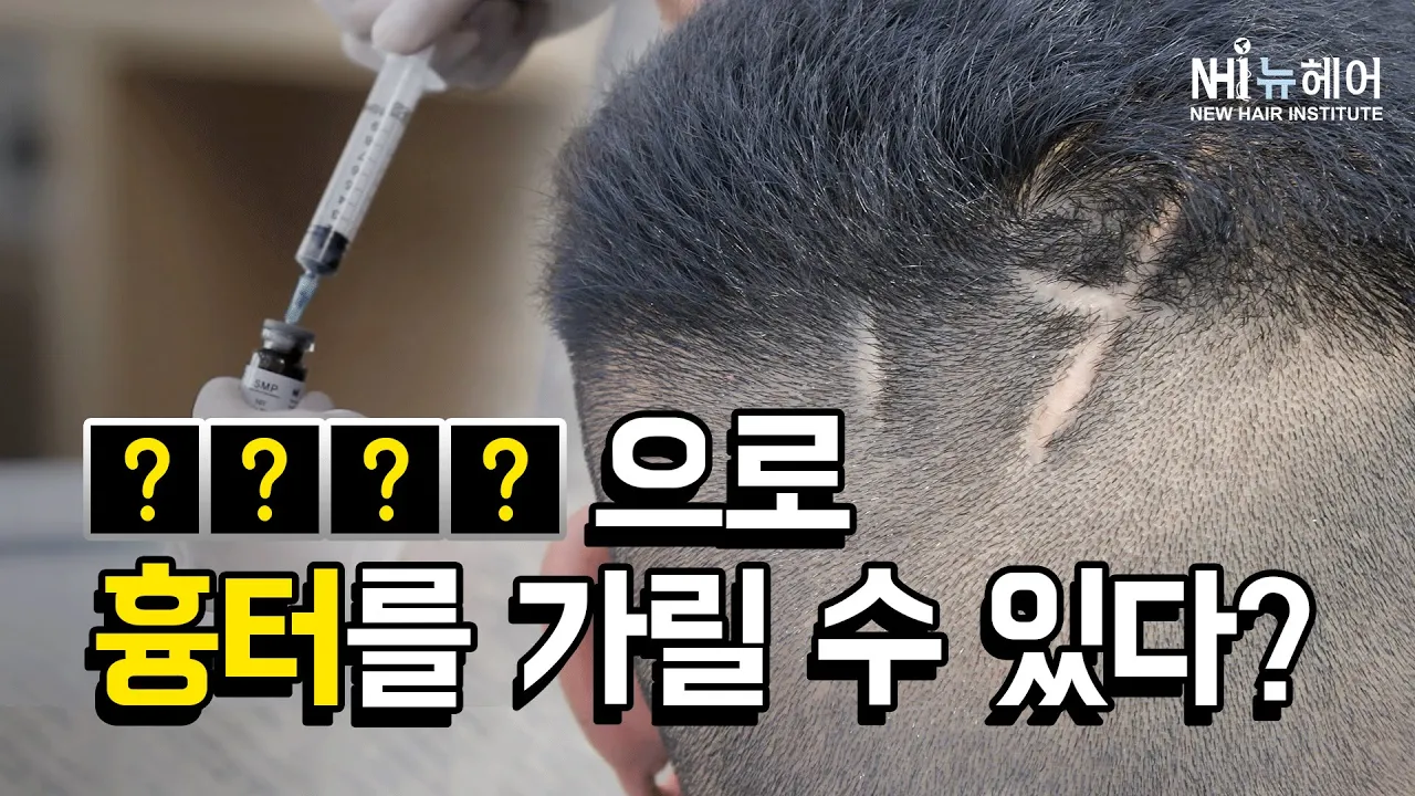 두피문신으로 흉터를 가릴 수 있다? - 뉴헤어 I [두피문신][헤어라인]