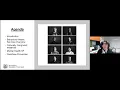FCM Grand Rounds San Francisco s Approach to Improving Behavioral Health Services