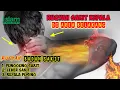 Download Lagu Ruqyah sakit kepala di area belakang ,kepala pusing, leher sakit dan punggung sakit surah Hud