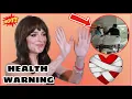 SHOCKING TRUTH Dakota Johnson s health is causing fans to panic