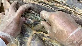 Músculos do dorso