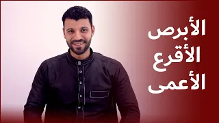 قصة الثلاثة الذي اراد الله ان يبتليهم 