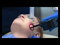 How does fractional CO2 laser resurfacing erase signs of aging
