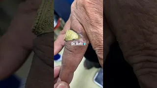 هل ترتدي الخاتم لفترة طويلة 