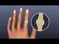 Mayo Clinic Minute Fighting arthritis with food