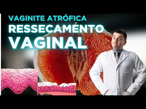 Download MP3 Vaginite Atrófica - Ressecamento pós menopausa (atrofia vaginal)