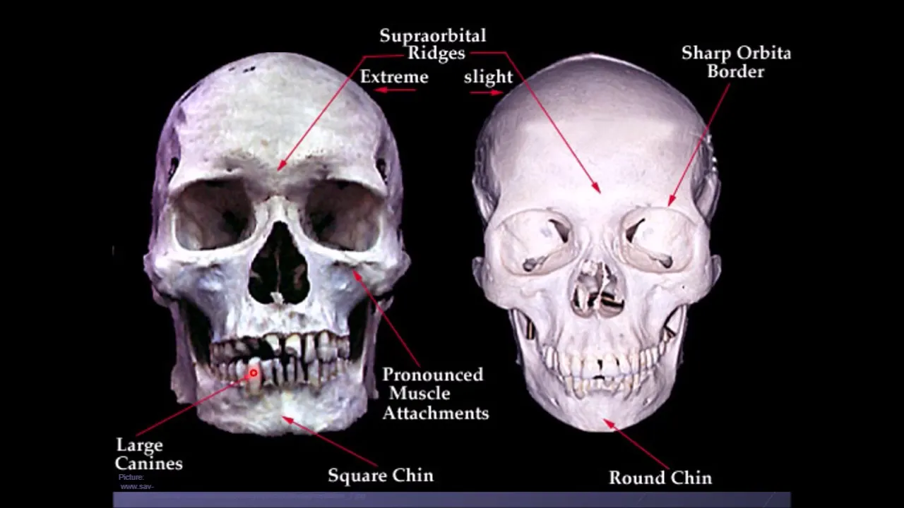 Forensic Anthropology: Estimating Age, Sex, and Stature