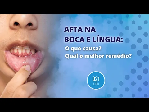 Download MP3 Afta na Boca e Língua: O que causa? Qual o melhor remédio?