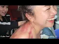 Download Lagu Cimel is tevreden met haar geschraap||Het is overal rood||het schraapt helemaal tot aan haar kont...