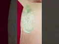 Doing a Brazilian wax at home