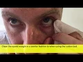 Lid hygiene