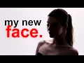 I Got Face Surgery