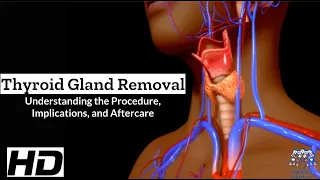 Thyroid Surgery Explained What They Don t Always Tell You