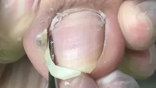 UM MILAGRE #satisfying 