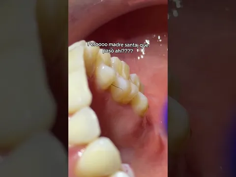 Con razón llegó tan feliz a consulta 🫣 #dentista #odontologia #shorts