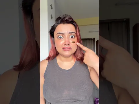 7Days Natural Wart Removal Cream 😱🤯 #shorts #trendinghacks #viralshorts #viral #winterhacks #7days