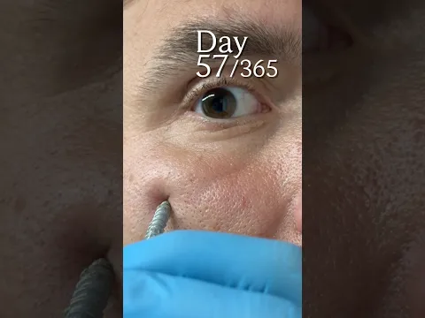 Day 57/365 Looksmaxxing