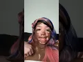 Download Lagu Make It Make Senseeeeee 🤔 | #vitiligo #explore #explorepage