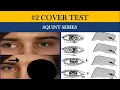 COVER TESTS Direct Cover Indirect cover Cover-Uncover and Alternate cover test