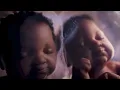 Cadbury | Triplets