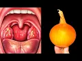 Download Lagu 130 keer sterker dan citroen en 30 keer sterker dan knoflook! Doder van bacteriën en schimmels!