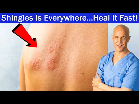 Download MP3 Shingles Is Everywhere...Heal It Fast!  Dr. Mandell