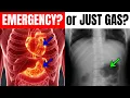 Pain Under Left Rib Cage EMERGENCY or Just Gas