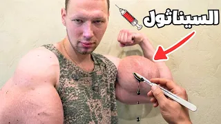 شاهد كيف تعمل حقن السيناثول داخل الجسم وكيف تبني العضلات_How Synthol injections work inside the body