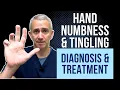 Hand Numbness Tingling Diagnosis Treatment