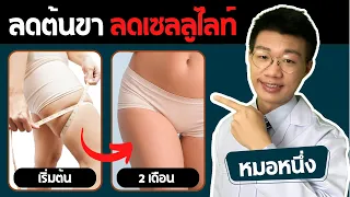 ฮอร์โมนส่งผลต่อการเกิดเซลลูไลท์อย่างไร
