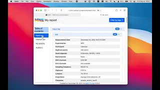 MNE-Python feature spotlight Reports