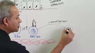 Asthma - Pathophysiology