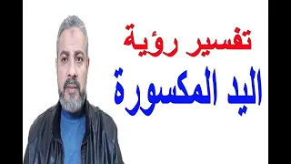 تفسير رؤية اليد المكسورة في المنام   اسماعيل الجعبيري دندنها