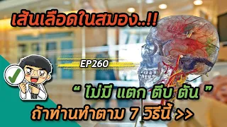 การออกกำลังกายอย่างถูกต้องช่วยป้องกันโรคหลอดเลือดในสมองได้อย่างไร?