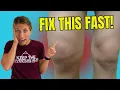Download Lagu Struggling with Knee Swelling? 3 Proven Ways to Bring It Down Fast!