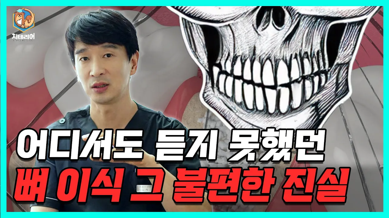임플란트 뼈이식 꼭 알고 하세요! #풀아치임플란트 #풀아치 #치과
