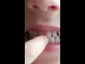What if Your Child Swallows a Tooth