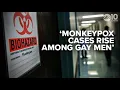 Download Lagu Gay men coming down with Monkeypox, Sacramento health officials say get vaccinated