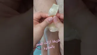طريقة ازالة الشعر بالحلاوة 