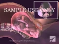 Download Lagu Childbirth - Normal Vaginal Delivery