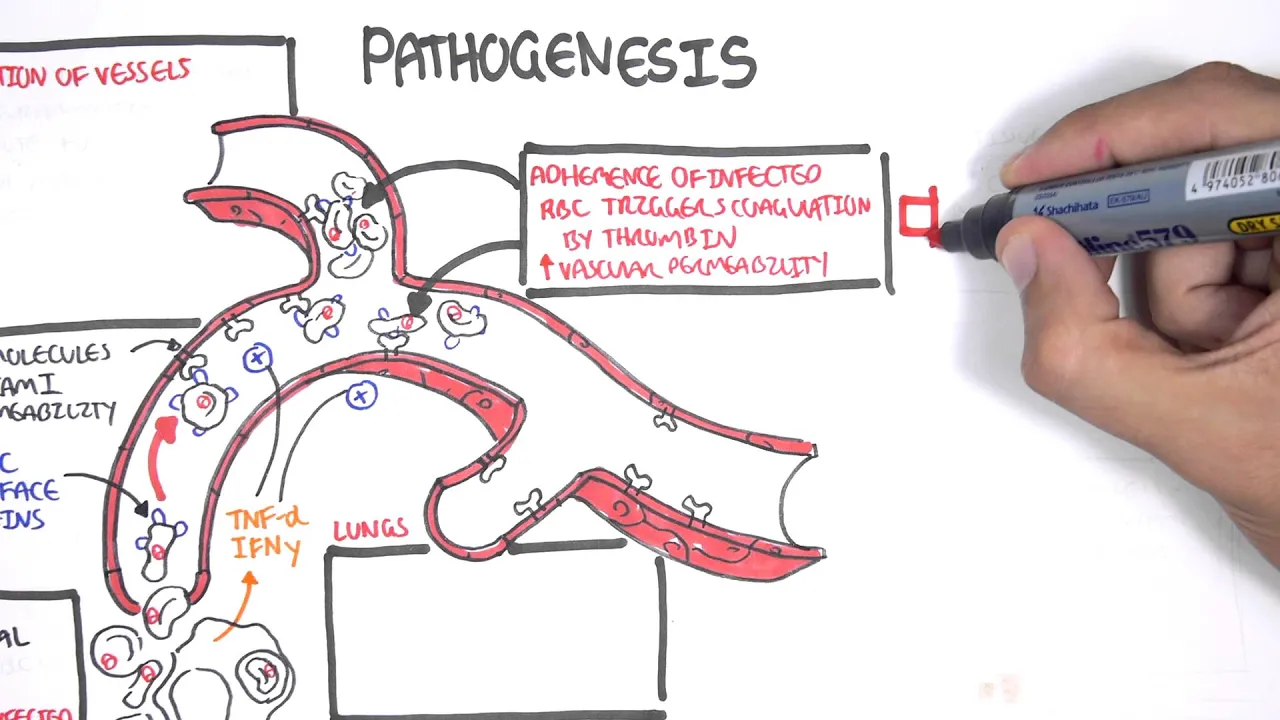 Malaria Pathophysiology