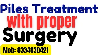Piles cure without surgery at once | how to get rid of hemorrhoids