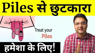 Download 10 Tips To Get Rid Of Piles | Piles Treatment At Home | पाइल्स का इलाज | by Dr. Saleem Zaidi MP3