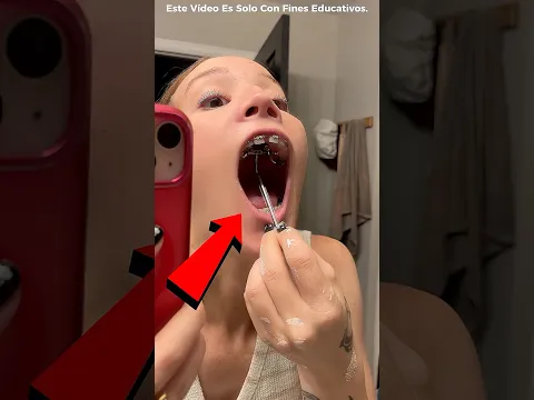 Ella Quería Un Sorriso Perfecto 😱