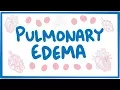 Pulmonary Edema - causes symptoms diagnosis treatment pathology