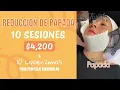 PROMOCIONES TWIST SPA SAN RAFAEL